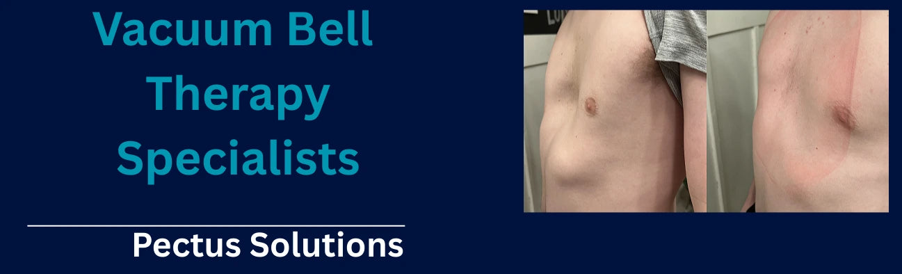 Pectus Solutions banner