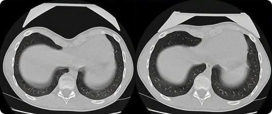 Vacuum bell before and after